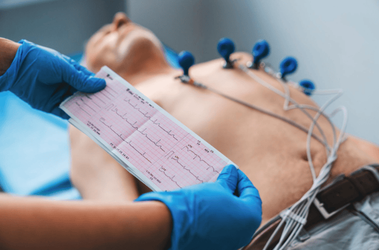 Arrhythmia & ECG Evaluation
