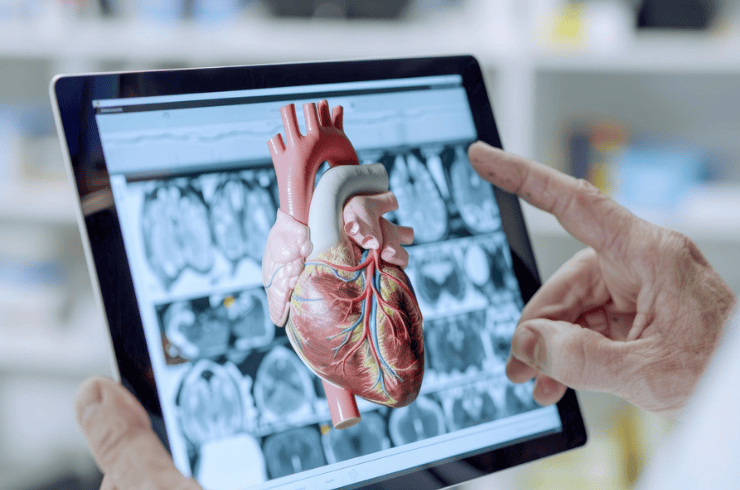 Coronary Imaging (IVUS/OCT)