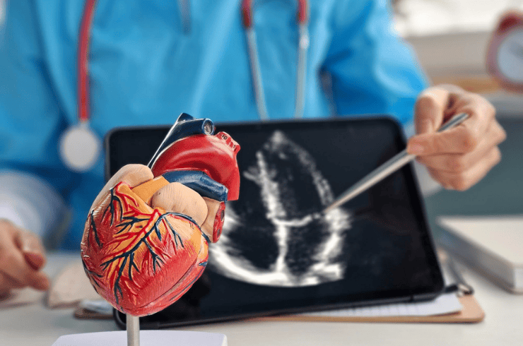 Coronary Angiography